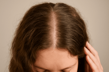 Torr hårbotten vs fet hårbotten: Förstå de viktiga skillnaderna för bättre hårvård