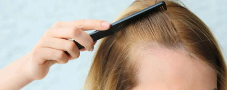Förstå traction alopecia: Orsaker, behandling och förebyggande