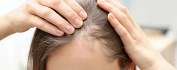 Små hårstrån i hårfästet