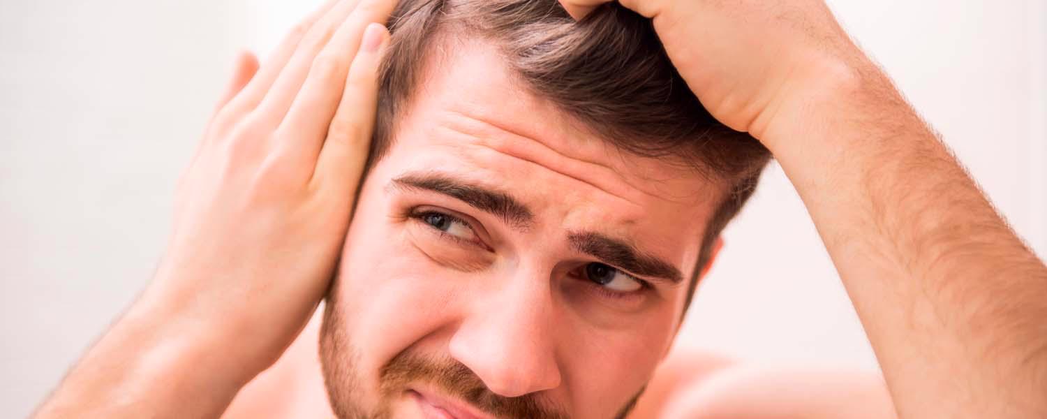 Man tittar på sitt tunna hår - Guide till håravfall hos män