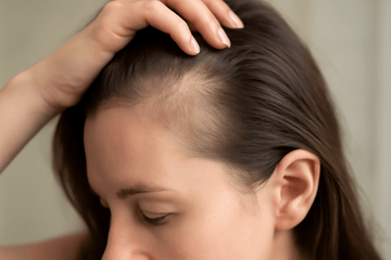 Varför blir mitt hår tunnare vid tinningarna? Förstå orsakerna och lösningarna