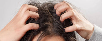 Öm och irriterad hårbotten - Bra guide om hur man behandlar en öm och irriterad hårbotten