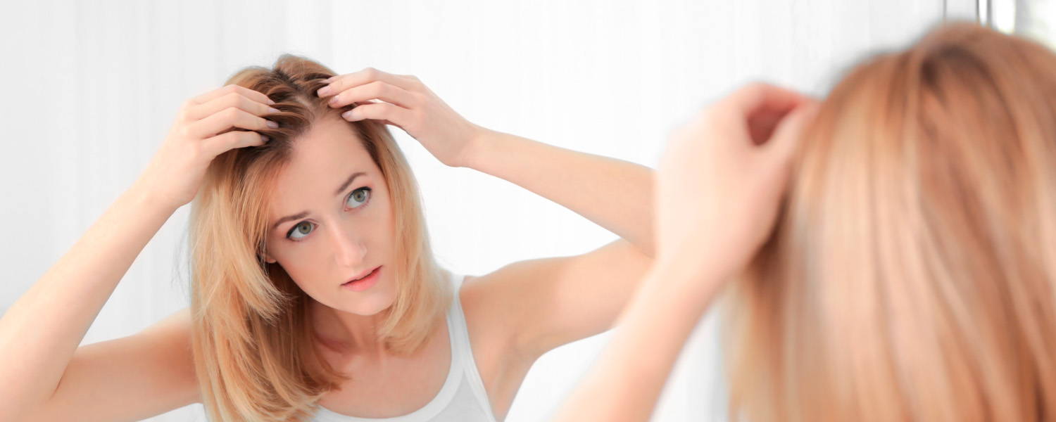 Alopecia areata: Guide för att behandla fläckig skallighet/håravfall