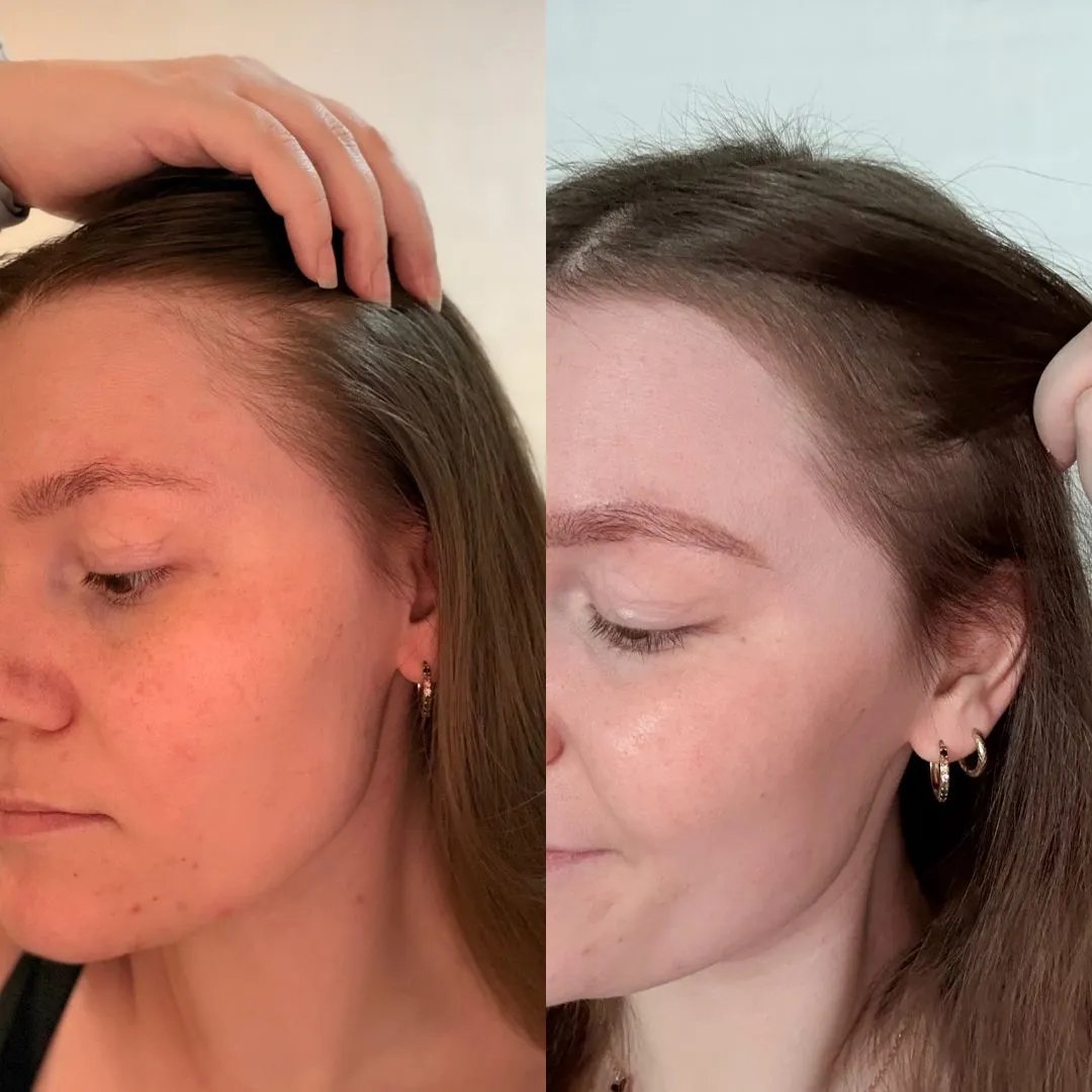 Frederikke